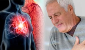 Bệnh tim mạch: Những điều quan trọng bạn cần biết
