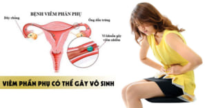 Cách phòng ngừa và điều trị viêm nhiễm phần phụ ở phụ nữ